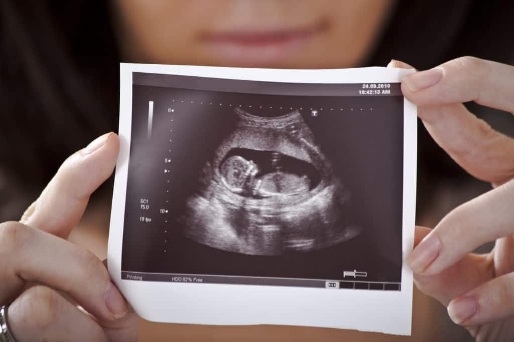 the ultrasound picture